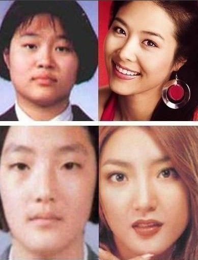 韩国男明星整容前后_韩国明星整容前后