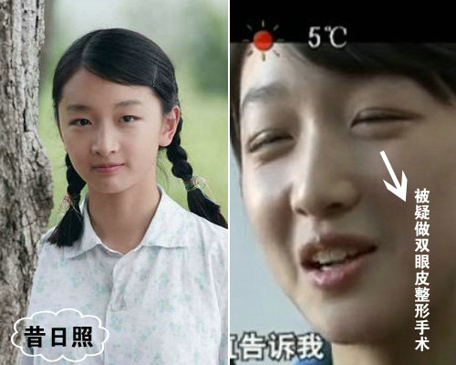 女星整容越整越美 <em>恐龙妹</em>变女神(组图)【5】--