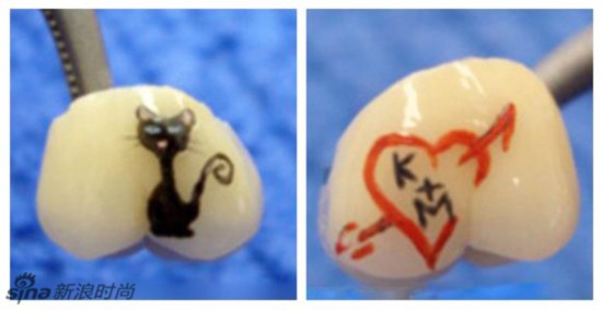 牙齿<em>纹身</em>引新潮 重口味身体艺术--时尚--人民网