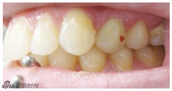 牙齿<em>纹身</em>引新潮 重口味身体艺术--时尚--人民网