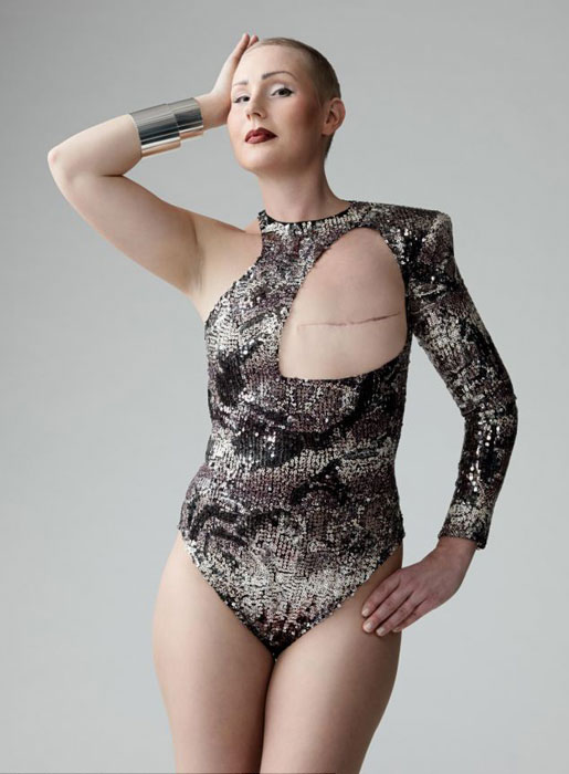 失乳女性也要美 设计师特制泳衣(图)