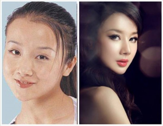 杨幂郑爽柳岩 图揭女星 整容前后 反差大(组图)【