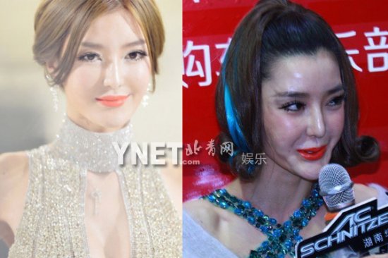 女星整容前后:Angelababy<em>龅牙妹</em>成绝世混血美