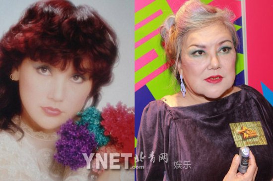 女星整容前后:Angelababy<em>龅牙妹</em>成绝世混血美