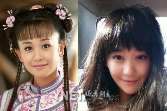 女星整容前后:Angelababy<em>龅牙妹</em>成绝世混血美