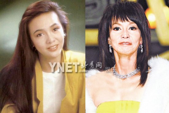 女星整容前后:Angelababy<em>龅牙妹</em>成绝世混血美