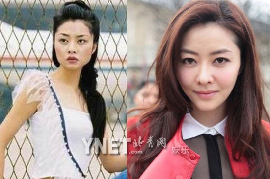 女星整容前后:Angelababy<em>龅牙妹</em>成绝世混血美