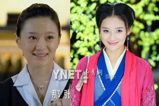 女星整容前后:Angelababy<em>龅牙妹</em>成绝世混血美