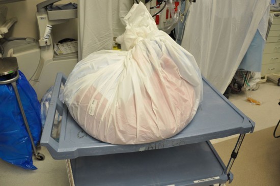 生殖器重达60公斤!49岁美男子因心脏病离世(图