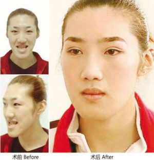 <em>超女</em>王梓惊爆木乃伊照没<em>自杀</em>去整容 揭秘娱圈