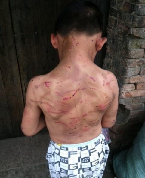 9岁男孩遭母亲长期虐待 被剪刀剪耳朵划脸(图