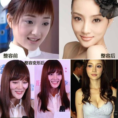 超女王梓惊爆整容木乃伊照 揭娱圈一众女星变