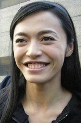 前超女王梓公开整容缠绷带惊悚 明星丑照比美照博眼球