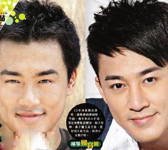 整容男星一览:古巨基割双眼皮图片