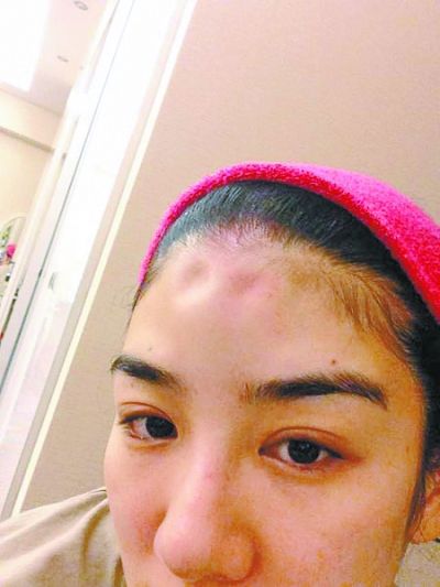 黄奕黄毅清离婚丑闻升级 家暴照片曝光黄奕头