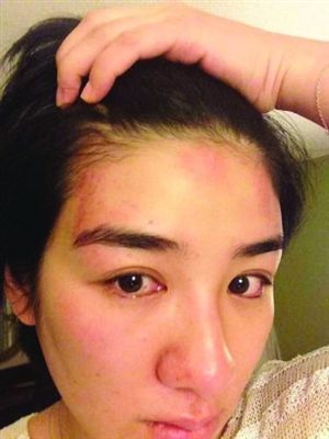 黄奕律师:不道歉就告!网友质疑家暴伤非殴打所致