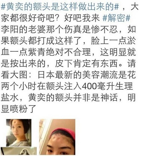 真人肥皂剧:疑似黄奕医院做家暴伪证过程全曝光(组图)