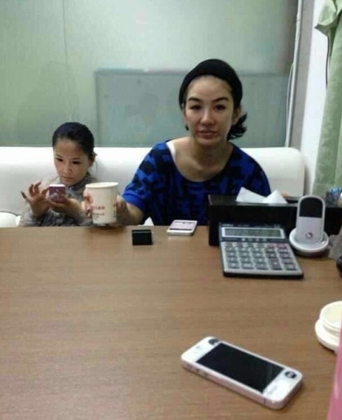 网友曝黄奕打玻尿酸现场照 自曝曾是医院员工