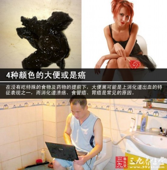 4种颜色的大便或是癌