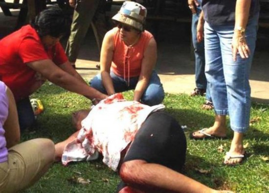 揭秘全球动物袭击人类的恐怖瞬间 鲨鱼咬人让