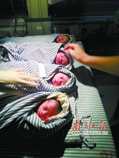 高州市人民医院首诞四胞胎 3女1男