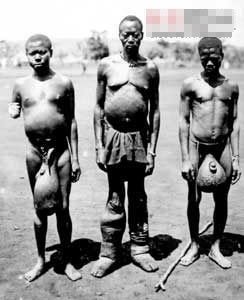 慎入!盘点全球最恐怖的十大怪病 [组图]