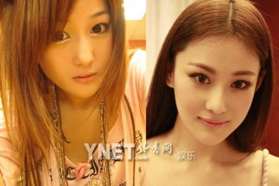 女星整容前后:Angelababy<em>龅牙妹</em>成绝世混血美