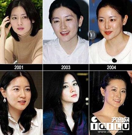 裴涩琪崔始源金泰熙Rain尹恩惠 韩星整容前后