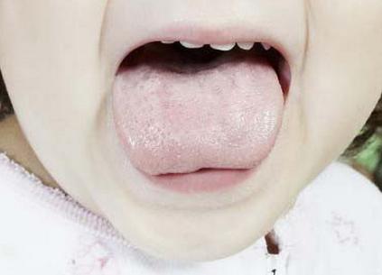 FѧAޭaܤ [Adp