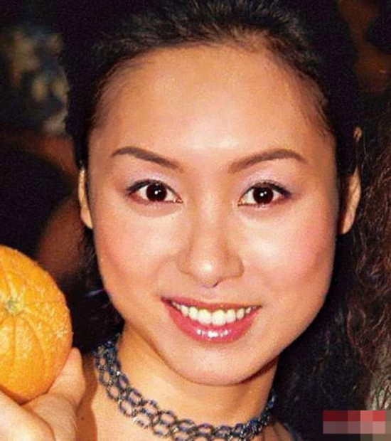 打玻尿酸开双眼皮都弱爆了 揭为变锥子脸不要