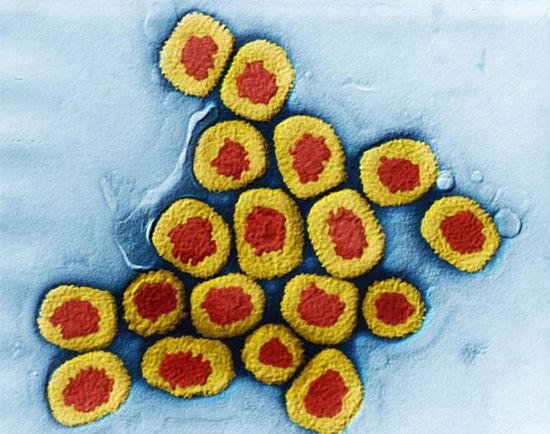 日本教授造超级病毒 罕见病毒彩照演绎危险芷