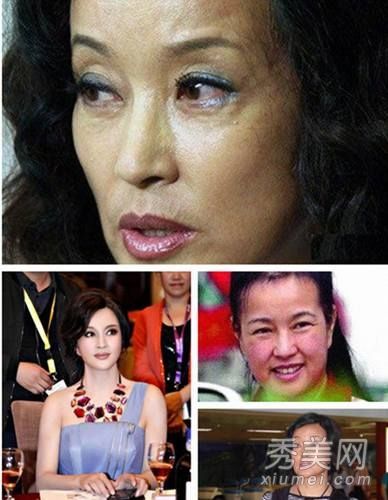 5招对抗坐出来的病    左下角是刘晓庆微博自拍照,除了化妆师技术