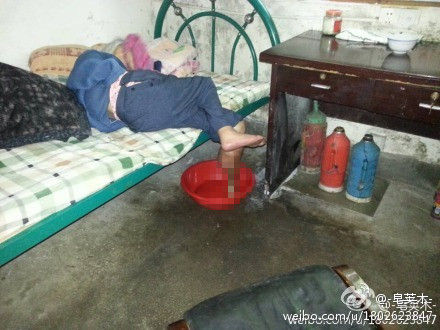 浙江安吉一敬老院虐待老人 95岁老人烂掉小腿