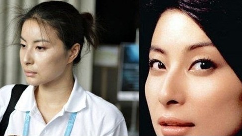 郭晶晶鼻子高刘亦菲眼睛突 明星缺项整容都没得救?