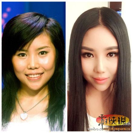大饼脸秒变锥子!盘点娱乐圈疑似整容的十大女星
