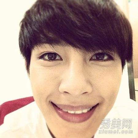 图揭明星整容后遗症 Baby柳岩嘴歪脸僵硬