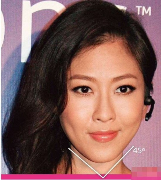 打玻尿酸开双眼皮都弱爆了 揭为变锥子脸不要