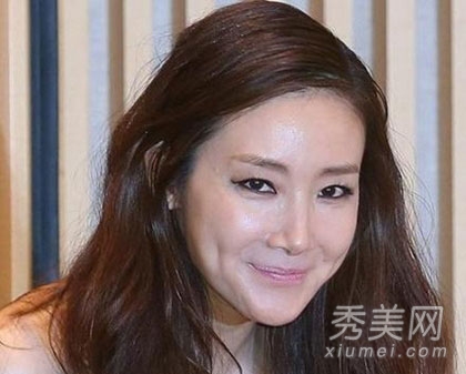 明星整容后遗症真可怕 崔智友面目全非