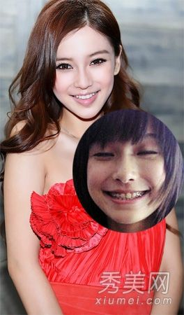 明星戴牙套:胡歌高圆圆Baby整牙胜过整容