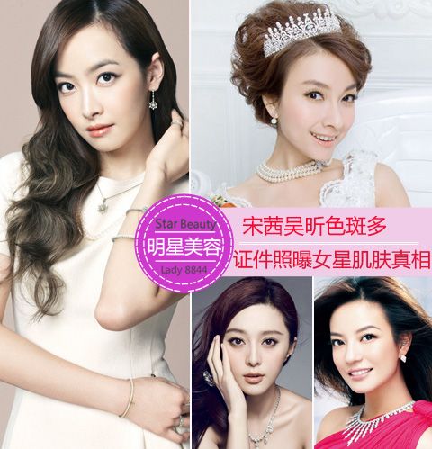 宋茜吴昕色斑多 证件照曝女星肌肤真相