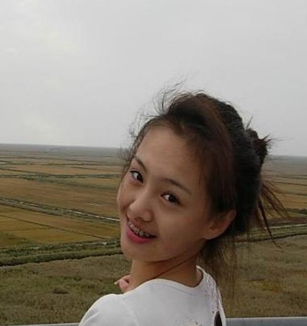 杨颖晒丑照首度承认整容 明星罕见带牙套照曝光