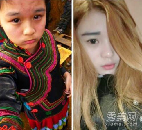 变形计主人公李耐阅 疑整容失败+失恋自残