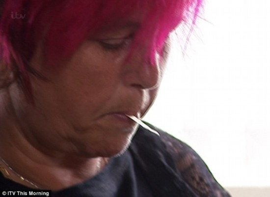 英国姐妹异食癖：姐吃蜡烛妹吃书