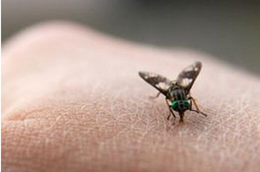 乌干达归来左臂挤出米粒大虫子 疑似感染人肤蝇