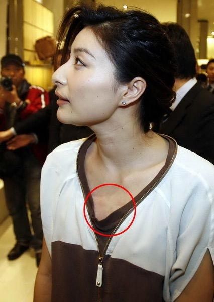 侧脖扭痧视频_扭痧 揪痧_扭痧图片_恐怖的扭痧图片 ...