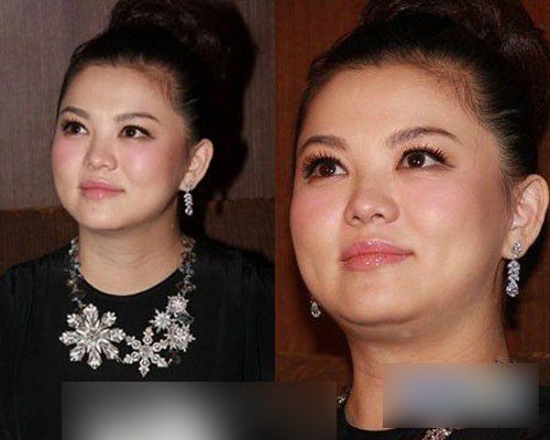 孙俪变大脸李湘成大妈 女星产后复出发福大盘点