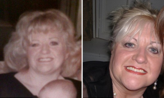 英54岁胖老太整容减肥年轻20岁