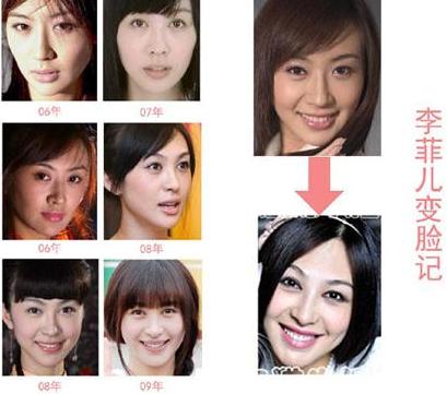  李易峰女友李菲儿 整容照大曝光 前女友李多海