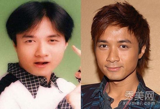 男星割双眼皮前后对比照【7】图片