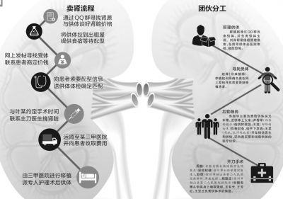 贩肾51枚涉案超千万15人获刑